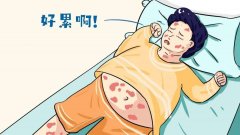 成都治牛皮癣到哪家医院好